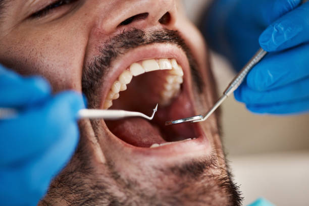 Best Mobile Emergency Dentist in Golden Hills, CA